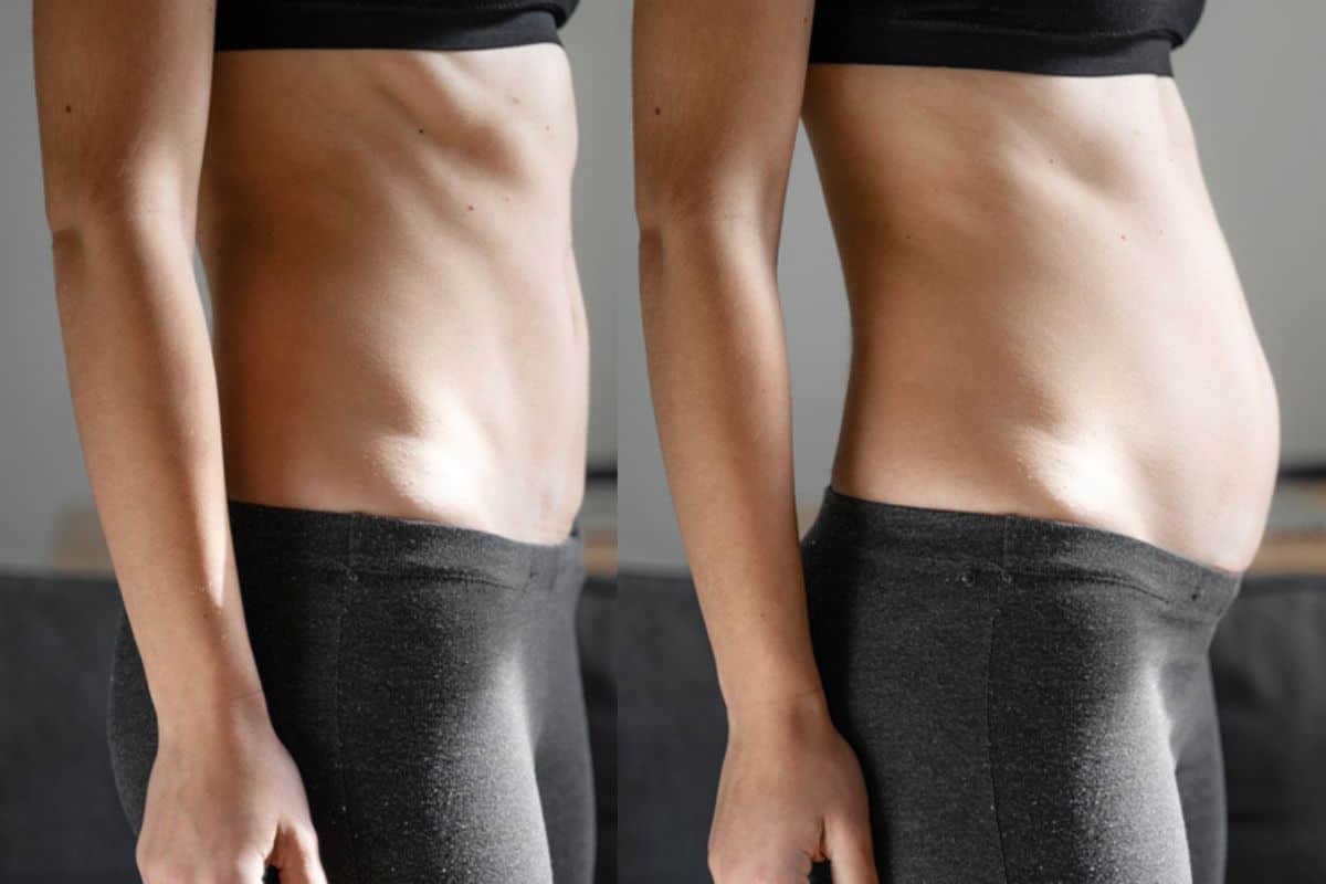 How long does diastasis recti take to improve Hale End?