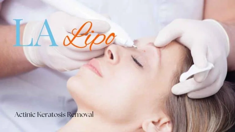 Woman receiving Actinic Keratosis Removal Treatment Hale End
