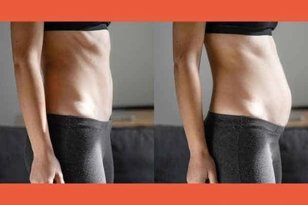 LA-EMS Body Sculpting results Hale End