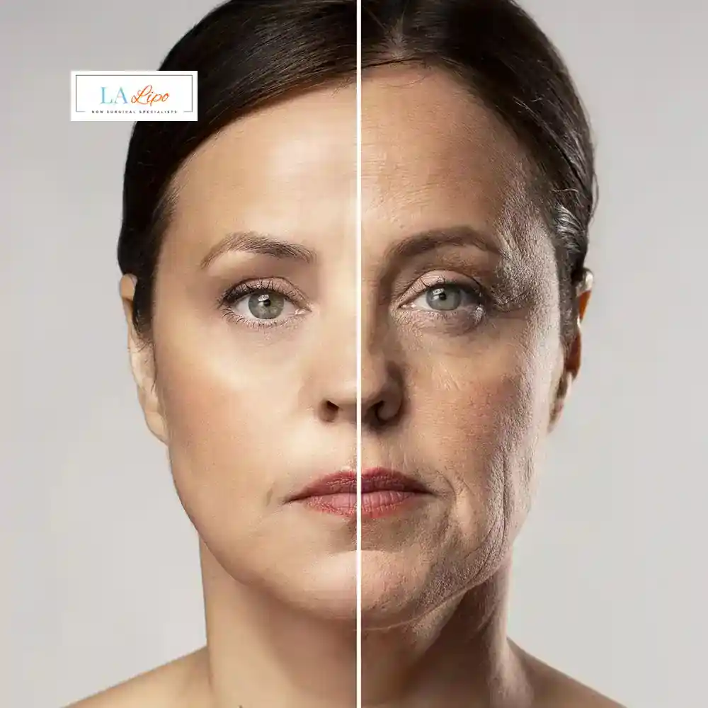 How Can You Tell If Non-Surgical Skin Tightening Is Right for You Hale End?