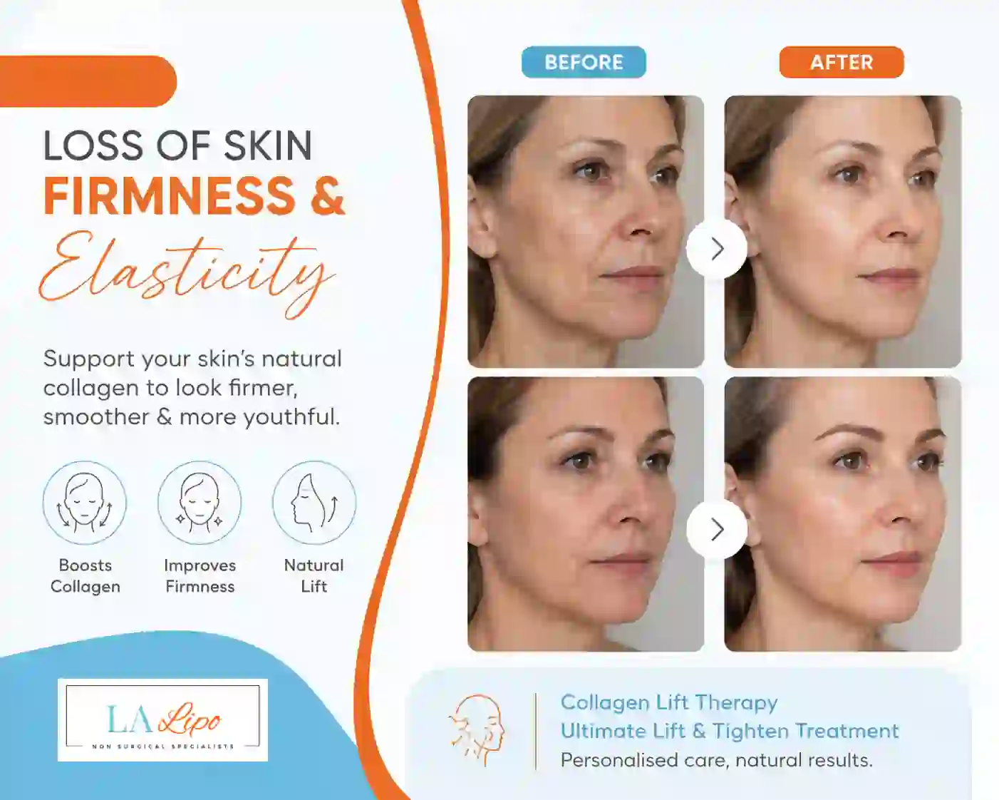 Sign #7: Loss of Skin Firmness and Elasticity Hale End
