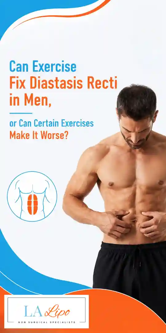 Can Exercise Fix Diastasis Recti in Men, or Can Certain Exercises Make It Worse Hale End?
