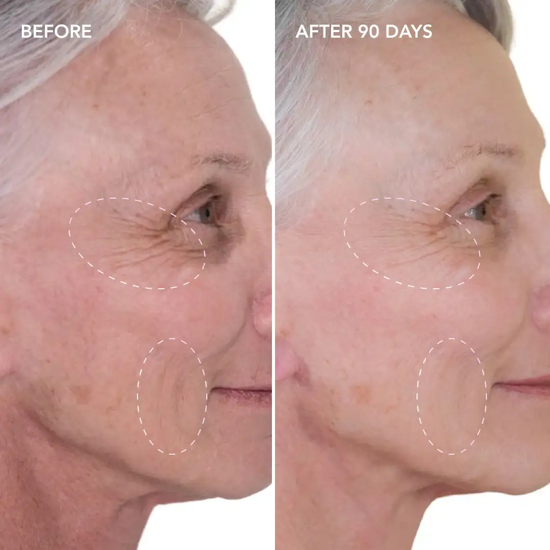 When will you see results Hale End